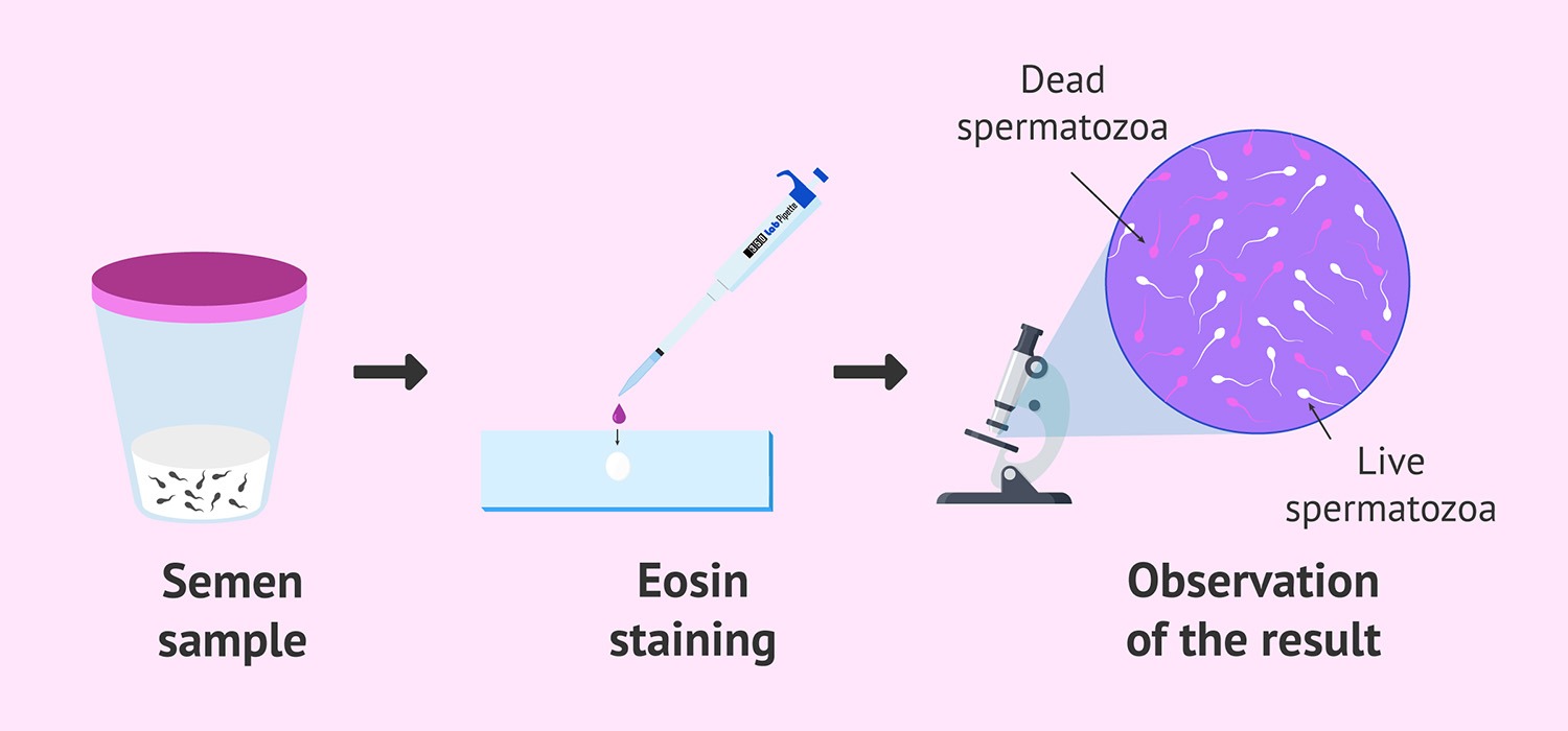 Sperm Vitality Kit - Image 2